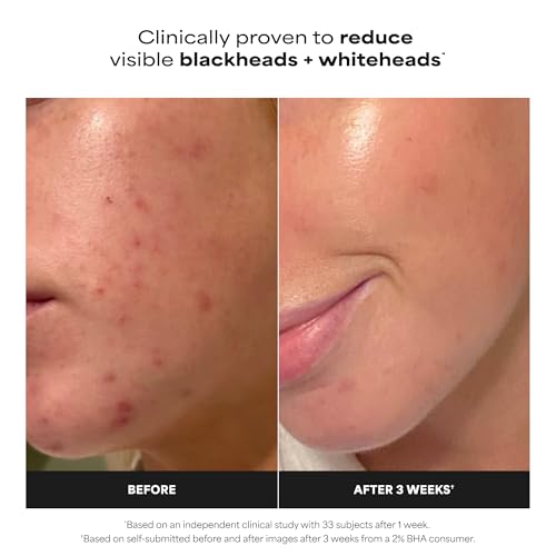 Paula's Choice SKIN PERFECTING 2% BHA Liquid Leave-On Exfoliant | Gentle Salicylic Acid Leave-On Facial Exfoliator for Blackheads, Enlarged Pores, Wrinkles & Fine Lines