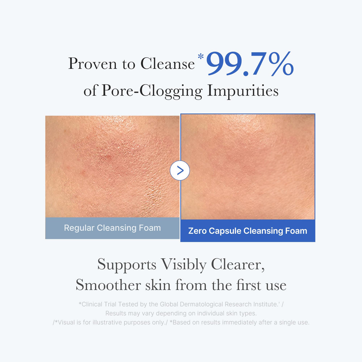 medicube Facial Cleanser Zero Pore Capsule Foam Cleanser | Daily Gentle Face Wash for Pore, Blackhead & Skin Texture Care, AHA BHA PHA for Deep Cleansing, Korean Skincare, 4.23 oz