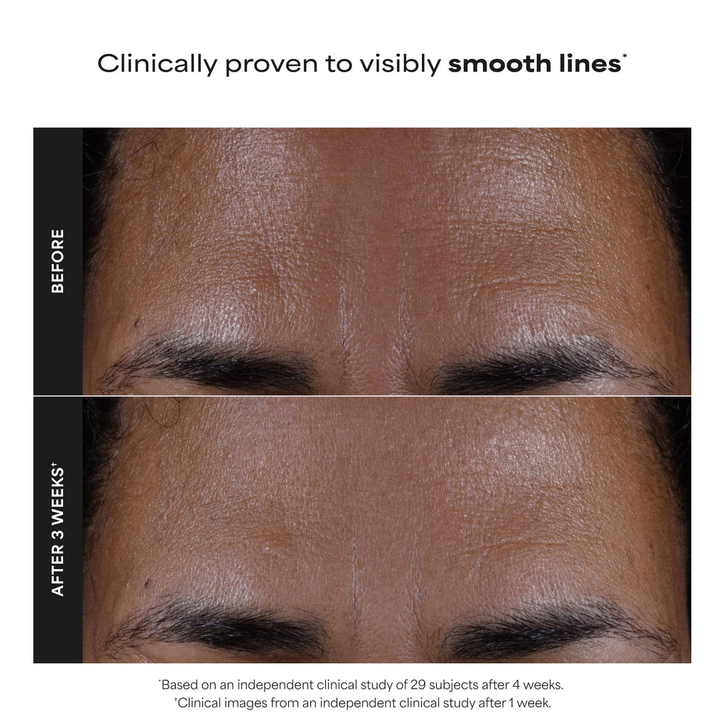 Paula's Choice SKIN PERFECTING 2% BHA Liquid Leave-On Exfoliant | Gentle Salicylic Acid Leave-On Facial Exfoliator for Blackheads, Enlarged Pores, Wrinkles & Fine Lines