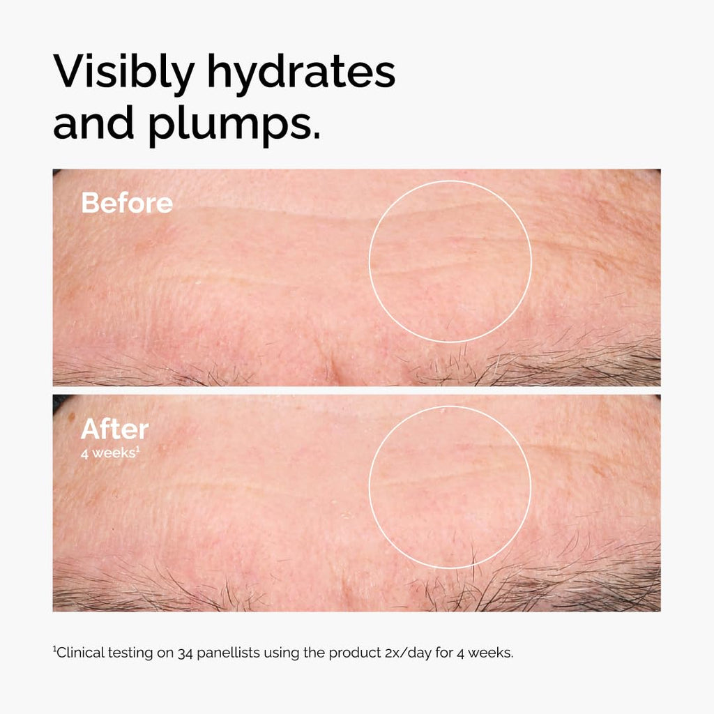The Ordinary Hyaluronic Acid 2% + B5 (with Ceramides), Multi-Depth Hydration Serum for Plumper, Smoother Skin