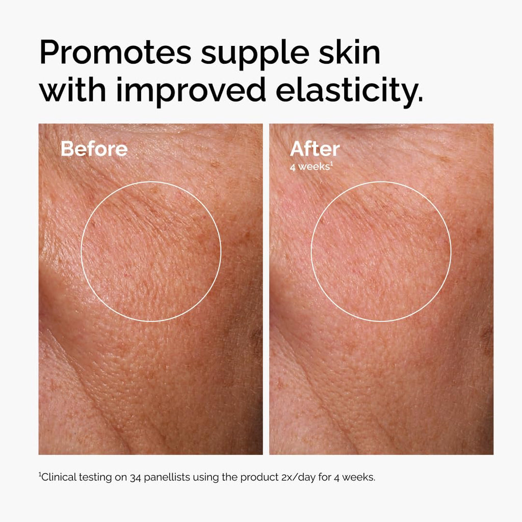 The Ordinary Hyaluronic Acid 2% + B5 (with Ceramides), Multi-Depth Hydration Serum for Plumper, Smoother Skin