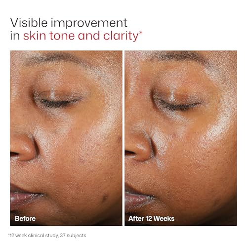 EltaMD UV Clear Face Sunscreen with Zinc Oxide, Oil-Free, SPF 46 and SPF 50 | Calms and Protects Acne-Prone Skin and Rosacea, No White Cast, Dermatologist Recommended, Available in Three Tints and Sizes